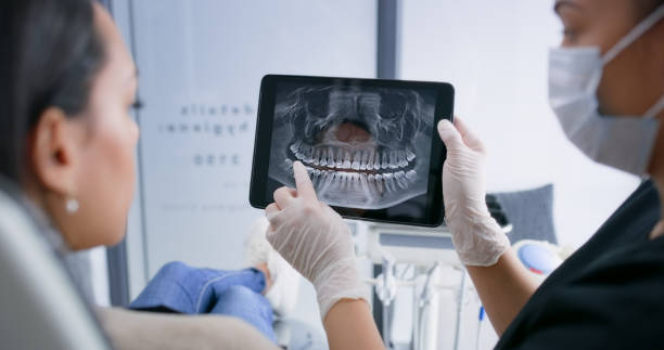 Licensed Dental Implants service in Linden, MI - Smile Center Dentistry